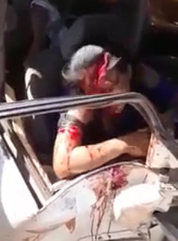 Ripped Woman's Face Turned Scarlet