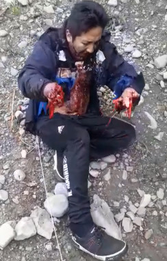 Grenade Explodes IN Protestor's Hands