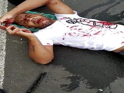 accident man in agony with broken leg