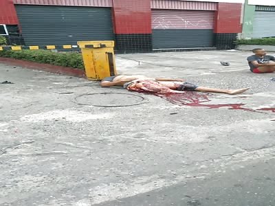 shocking .. Accident man with broken leg