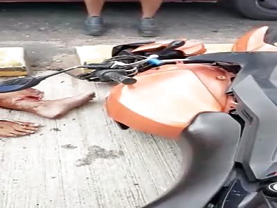 woman suffers accident