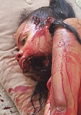 Fucking Terrible Face Reconfiguration