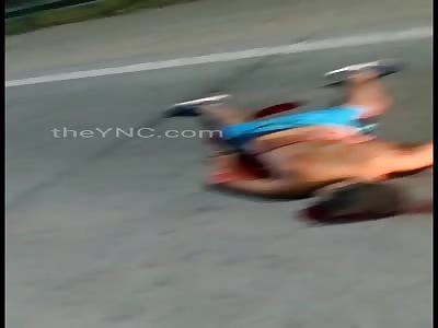 Shocking man with intestines out after accident (still alive)