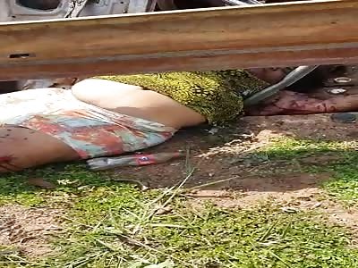 Woman in agony after accident