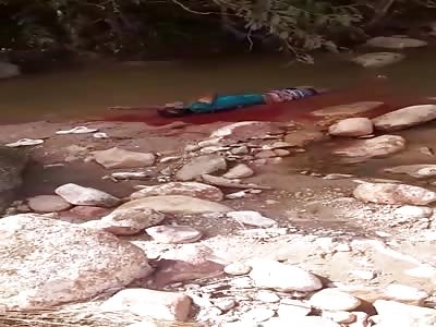 Man agonizing after Shots