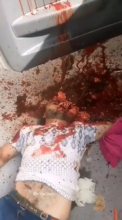 Exposed Brain and a Disturbing Face