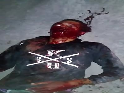 Shocking man in agony 