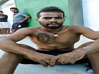 Man expect medical help after being shot twice 