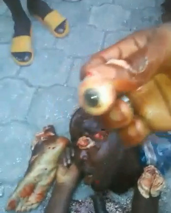 African Goons Dismember Rival And Gouge Out His Eyes