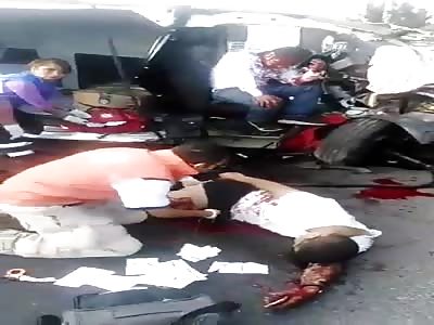  The fucking bike.. Motorsicist in agony with his leg shatte