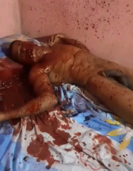 The Bullets Left Bloody Mess