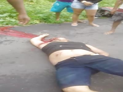 Motorcyclist in agony after accident 