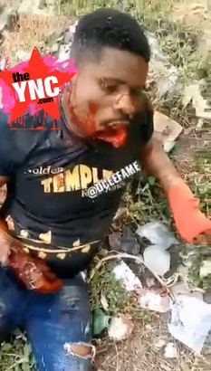 Machete Turned His Face into Halloween Mask