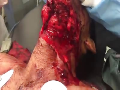 DAMN! Man Is Fully Awake With a Throat Slit