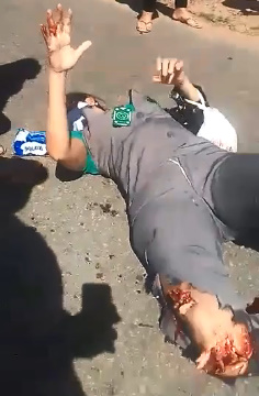 Pretty Girl Moans in Pain Suffering Nasty Leg Injury