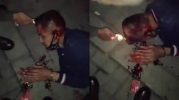  Burns His Head With A Lighter And Kick Him