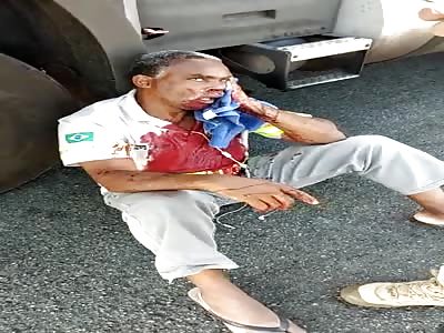 The trucker was shot in the face in an attempted robbery Brazil