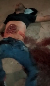 AGONY:  Guts Protrude from Midsection