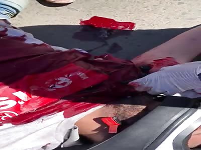 Motorcyclist in agony after accident 