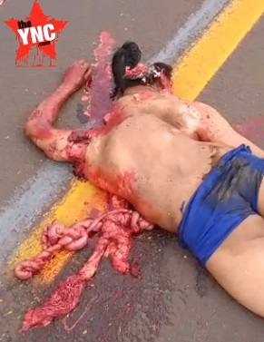 Left Unrecognizable in a Street Wreck