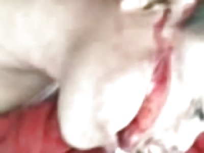 Shocking. Young man in agony with big cut on his face 