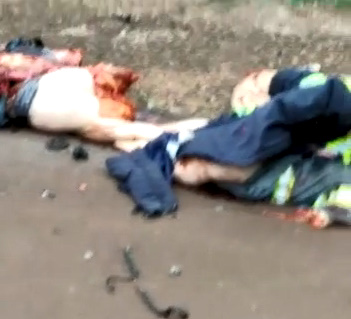 Mangled Limbs: Terrible Bike Accident Aftermath