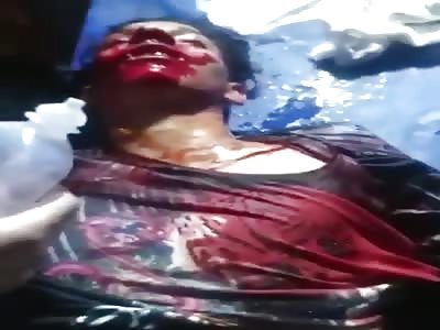 Consequence of car bomb attack 