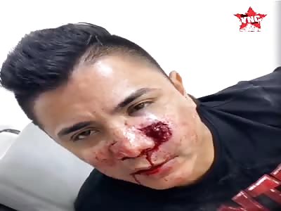Mauro Bastidas, actor and singer of Cali Was shot in the face in robbe