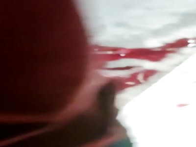 Accident, Man With The Broken Loss 