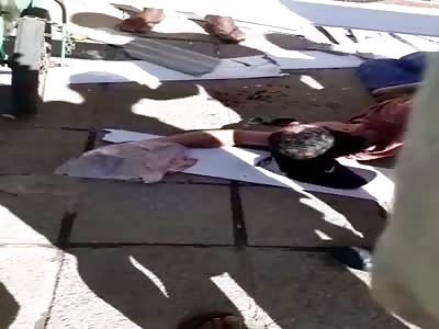 man in agony after accident 