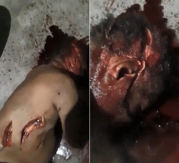 Hacked Up Like a Piece of Raw Pork