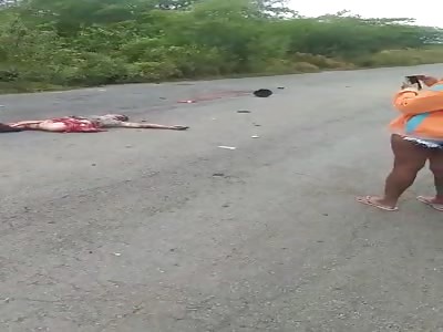 MANGLED LIMBS: TERRIBLE BIKE ACCIDENT AFTERMATH