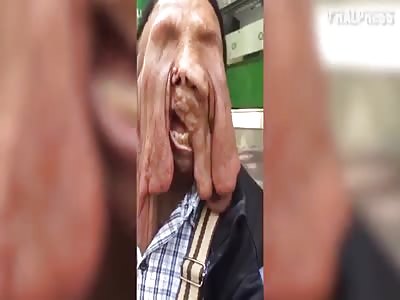 Wtf. Cancer in the face