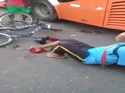 Shit. Grandfather.. Lose your foot in accident 