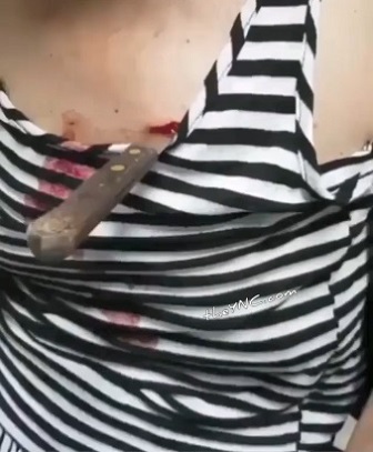 Woman Stabs Herself after Broke up With Her Boyfriend 