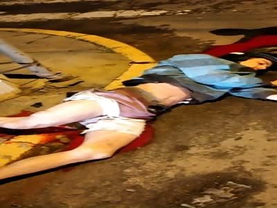 motorcyclist vs car.  (motorcyclist with shattered leg)