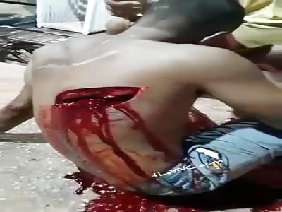 shit . Man With Large Machete Cut