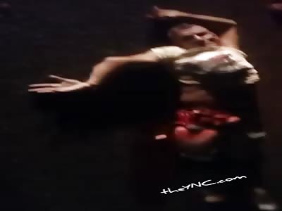 shit man with intestines out of stomach after accident