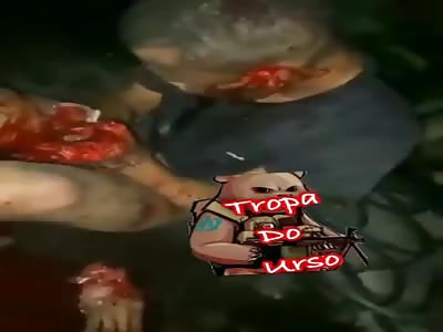 Man with smashed hands.