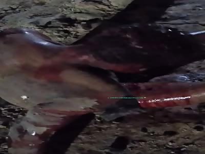 Man with multiple cuts after attack.