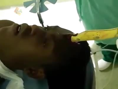 Shocking, man with a knife stuck in his head.