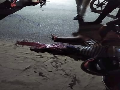 Motorcyclist in agony after accident.