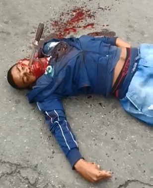 Huge Knife Is Still In His Face