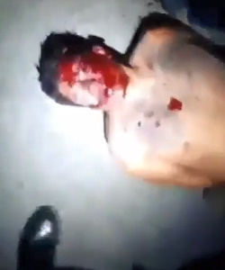 Robber Meets a Painful End