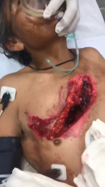 Wtf. Great Machete Cut Exposes Homeboys Heart.