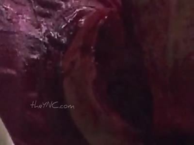 Man in agony after being attacked with machetes .