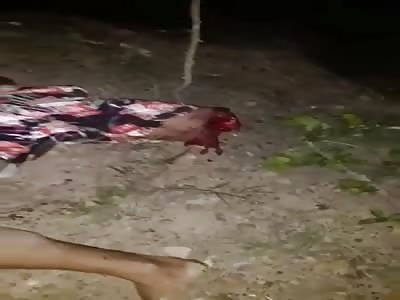 Brutal accident.  motorcyclist loses leg in accident.