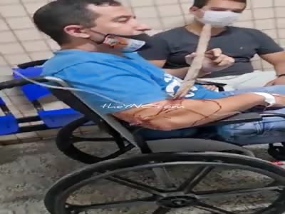 WTF..man in agony with a stick stuck in his arm. 