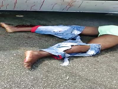 FULL GORE ,, MAN WITH EXPLOITED STOMACH AFTER ACCIDENT