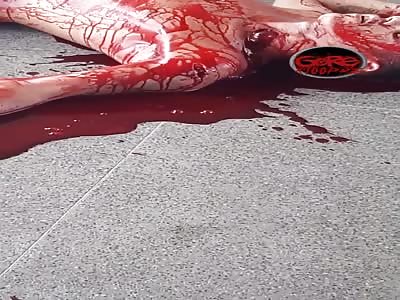 Man Bleeding Out Struggling To Breathe After Slitting His Throat With a Bottle